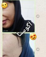 نمونه استفاده از کرم اگوستا