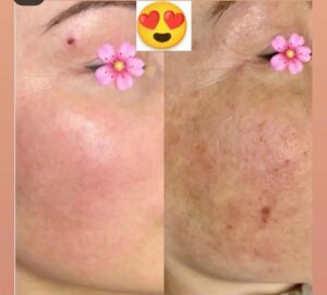 قیمت کرم گلدن شاین