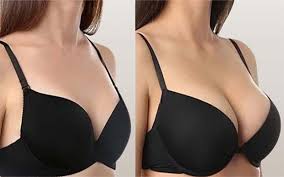عکس قبل و بعد استفاده از ژل سینه